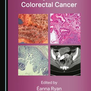 Hereditary and Familial Colorectal Cancer (Original PDF from Publisher)