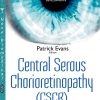 Central Serous Chorioretinopathy: Risk Factors, Diagnosis and Management (ORIGINAL PDF from Publisher)