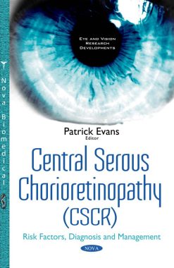 Central Serous Chorioretinopathy: Risk Factors, Diagnosis and Management (ORIGINAL PDF from Publisher)