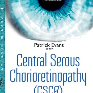 Central Serous Chorioretinopathy: Risk Factors, Diagnosis and Management (ORIGINAL PDF from Publisher)
