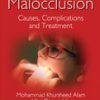 Malocclusion: Causes, Complications and Treatment (Original PDF from Publisher)