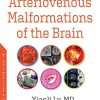 Arteriovenous Malformations of the Brain (Original PDF from Publisher)