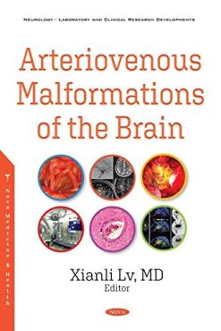 Arteriovenous Malformations of the Brain (Original PDF from Publisher)
