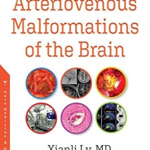 Arteriovenous Malformations of the Brain (Original PDF from Publisher)