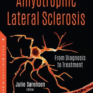 Amyotrophic Lateral Sclerosis: From Diagnosis to Treatment (Original PDF from Publisher)