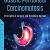 Gastric Peritoneal Carcinomatosis: Principles of Surgery and Treatment Options (Original PDF from Publisher)