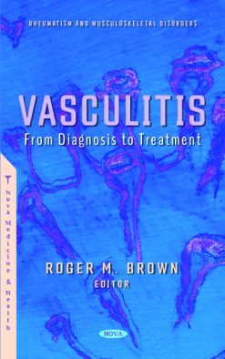 Vasculitis: From Diagnosis to Treatment (Original PDF From Publisher)