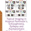 Typical Imaging in Atypical Parkinson’s, Schizophrenia, Epilepsy and Asymptomatic Alzheimer’s Disease (Original PDF From Publisher)