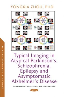 Typical Imaging in Atypical Parkinson’s, Schizophrenia, Epilepsy and Asymptomatic Alzheimer’s Disease (Original PDF From Publisher)