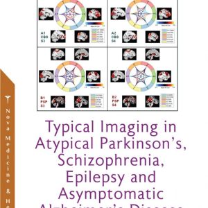 Typical Imaging in Atypical Parkinson’s, Schizophrenia, Epilepsy and Asymptomatic Alzheimer’s Disease (Original PDF From Publisher)