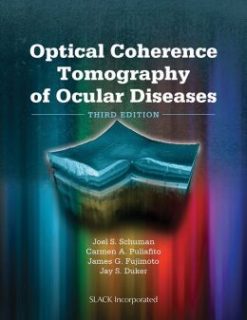 Optical Coherence Tomography of Ocular Diseases (ORIGINAL PDF from Publisher)