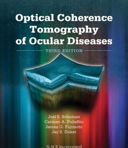 Optical Coherence Tomography of Ocular Diseases (ORIGINAL PDF from Publisher)