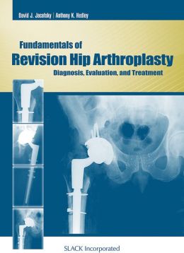 Fundamentals of Revision Hip Arthroplasty: Diagnosis, Evaluation, and Treatment