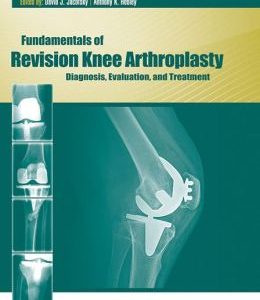 Fundamentals of Revision Knee Arthroplasty: Diagnosis, Evaluation, and Treatment (ORIGINAL PDF from Publisher)