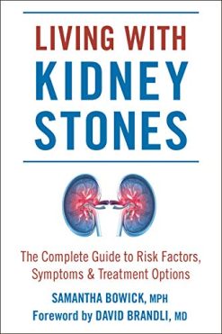 Living with Kidney Stones: Complete Guide to Risk Factors, Symptoms & Treatment Options (Epub)