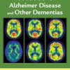 The American Psychiatric Publishing Textbook of Alzheimer Disease and Other Dementias (Original PDF from Publisher)