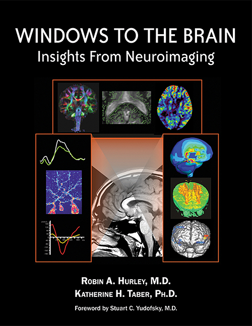 Windows to the Brain: Insights From Neuroimaging (Original PDF from Publisher)