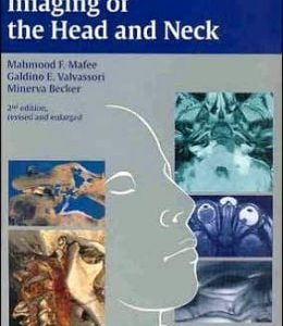 Imaging of the Head and Neck, 2nd Edition (Original PDF from Publisher)