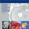 Atlas of Microsurgery of the Lateral Skull Base, 2nd Edition