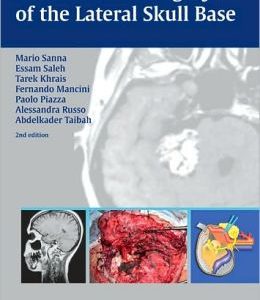 Atlas of Microsurgery of the Lateral Skull Base, 2nd Edition