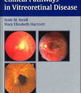 Clinical Pathways In Vitreoretinal Disease