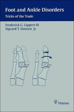 Foot and Ankle Disorders: Tricks of the Trade