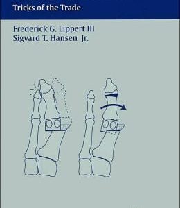 Foot and Ankle Disorders: Tricks of the Trade