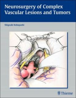Neurosurgery of Complex Vascular Lesions and Tumors