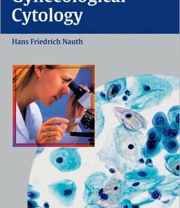 Gynecologic Cytology
