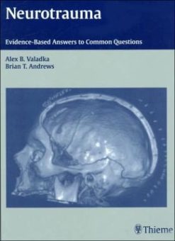 Neurotrauma: Evidence-Based Answers to Common Questions