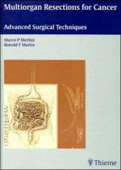 Multiorgan Resections for Cancer: Advanced Surgical Techniques