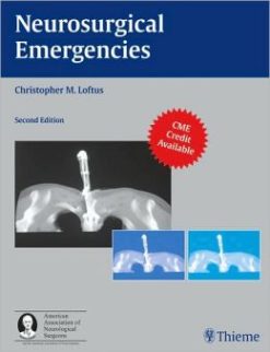 Neurosurgical Emergencies, 2nd Edition