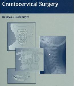 Advanced Pediatric Craniocervical Surgery