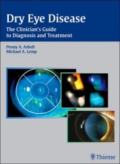 Dry Eye Disease: The Clinician’s Guide to Diagnosis and Treatment