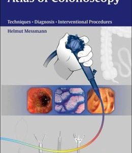 Atlas of Colonoscopy: Examination Techniques and Diagnosis