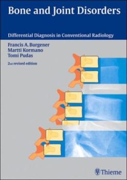 Bone and Joint Disorders, 2nd Edition