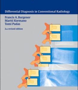 Bone and Joint Disorders, 2nd Edition