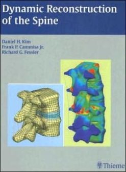 Dynamic Reconstruction of the Spine