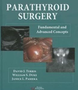Parathyroid Surgery: Fundamental and Adavnaced Concepts