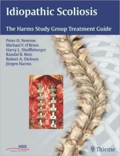 Idiopathic Scoliosis: The Harms Study Group Treatment Guide