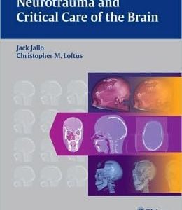 Neurotrauma and Critical Care of the Brain
