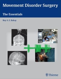 Movement Disorder Surgery: The Essentials (Original PDF from Publisher)