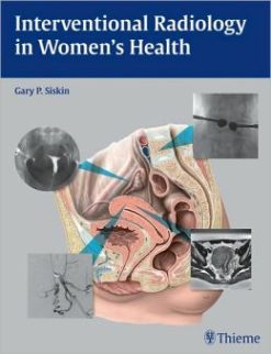 Interventional Radiology in Women’s Health