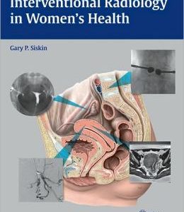 Interventional Radiology in Women’s Health