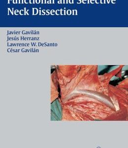Functional and Selective Neck Dissection