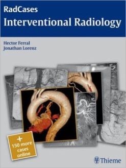Interventional Radiology (RadCases)