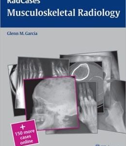 Musculoskeletal Radiology (RadCases)
