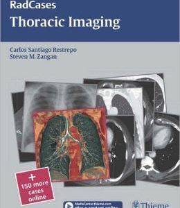 Thoracic Imaging (RadCases) (ORIGINAL PDF from Publisher)