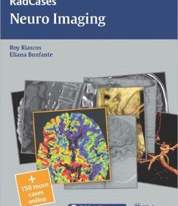 Neuro Imaging (RadCases) (ORIGINAL PDF from Publisher)