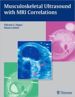 Musculoskeletal Ultrasound with MRI Correlations (ORIGINAL PDF from Publisher)